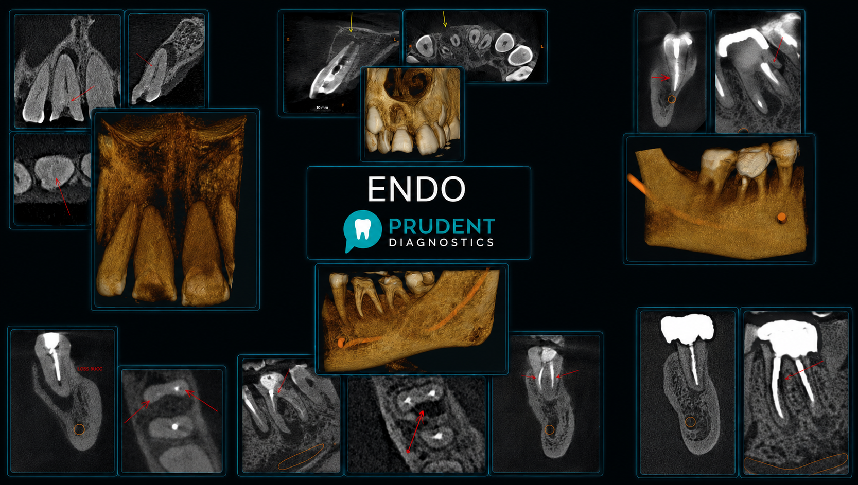 ENDO - Prudent Diagnostics