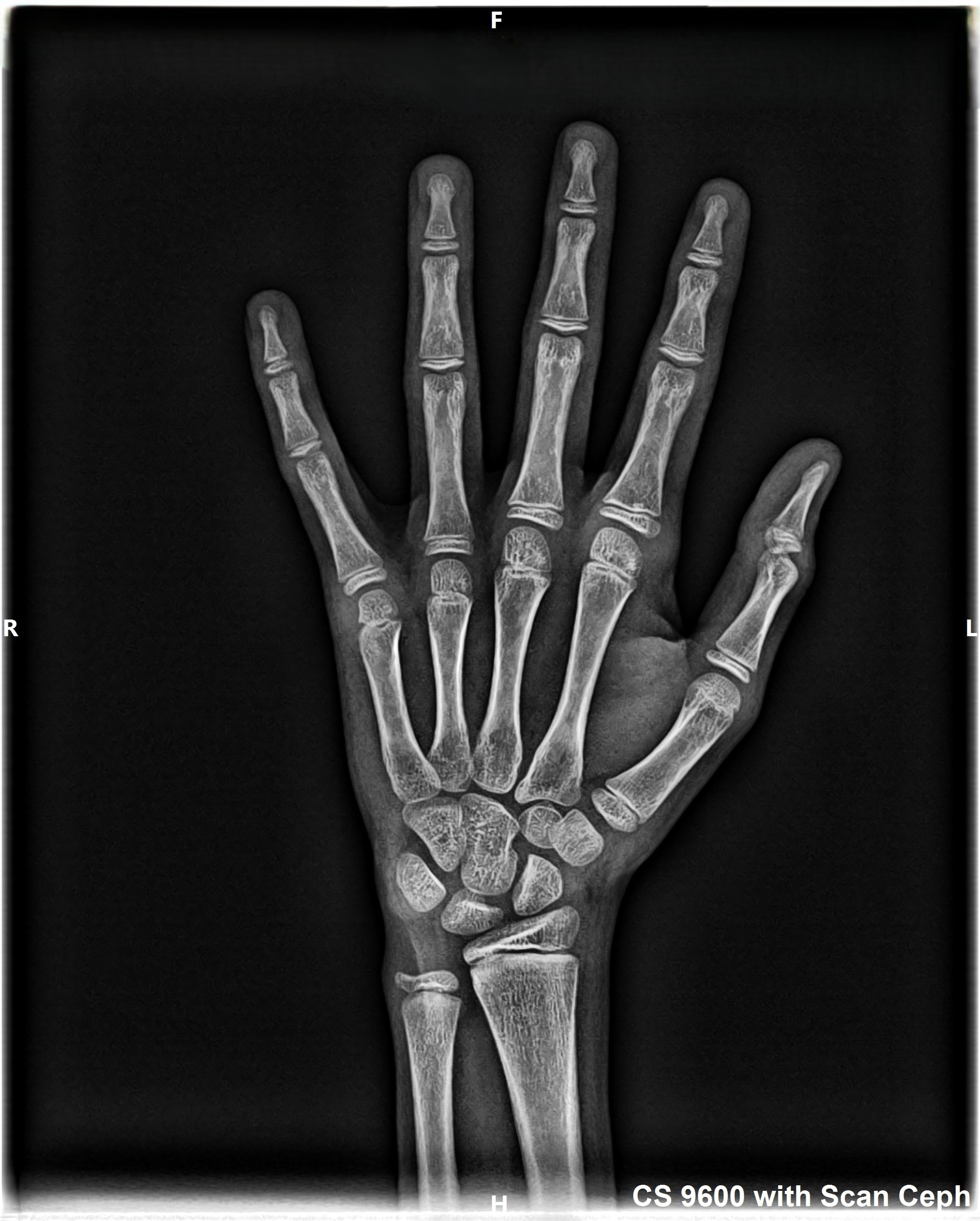 Hand 5