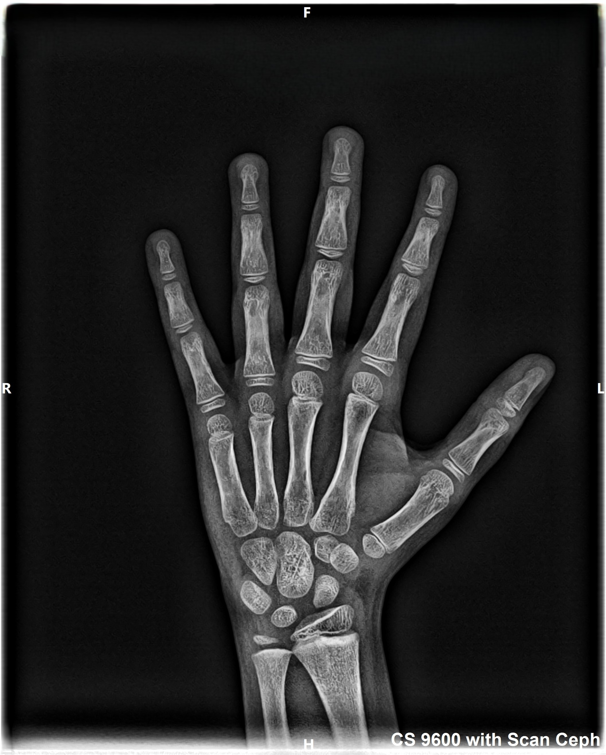 Hand 7