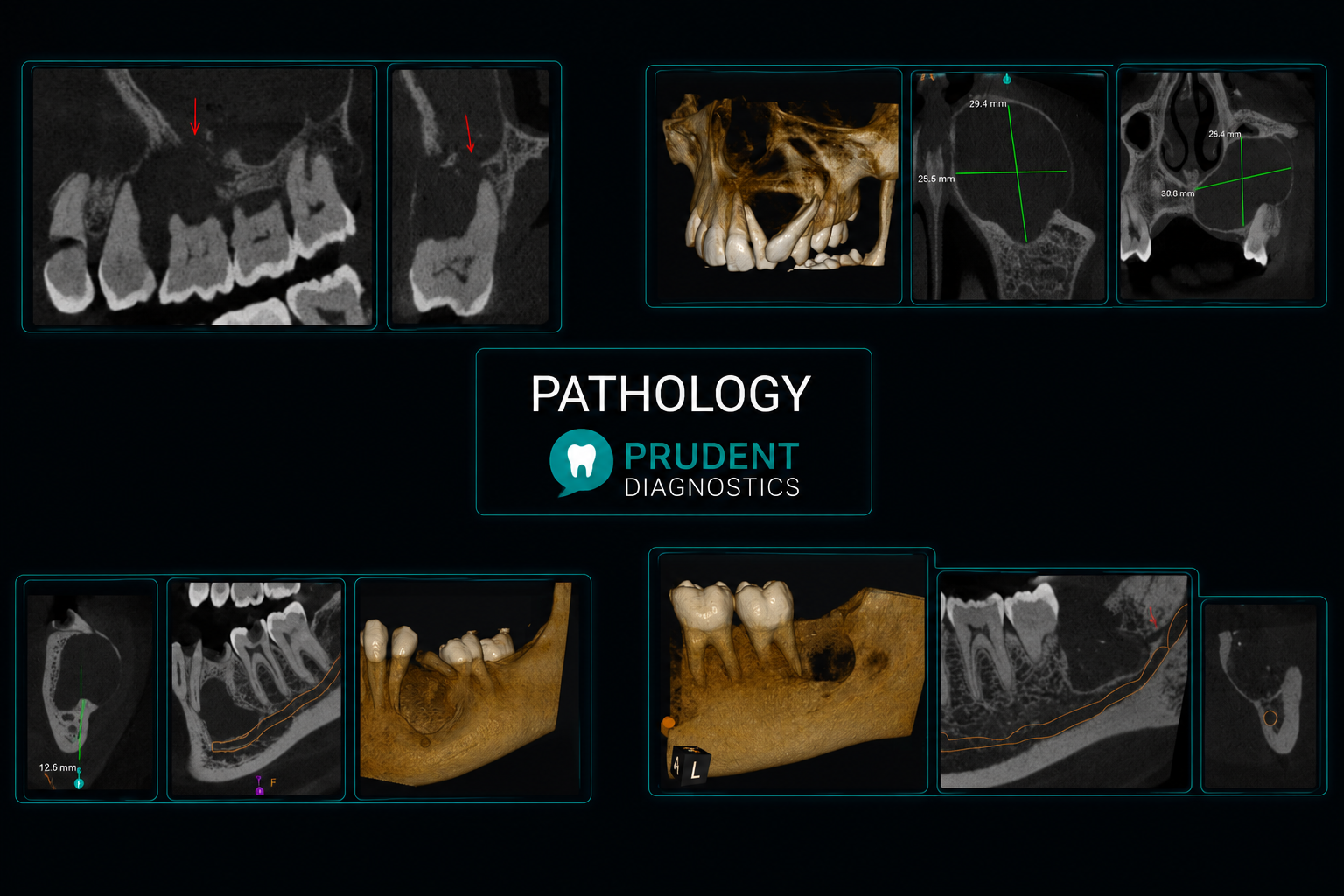 PATHOLOGY - Prudent Diagnostics