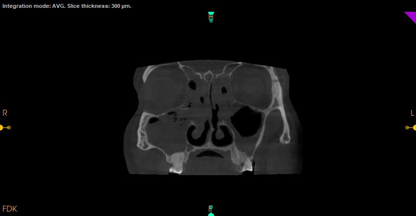 PNS Scan